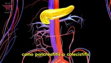 Cúrcuma si tiene ESTOS problemas de salud!