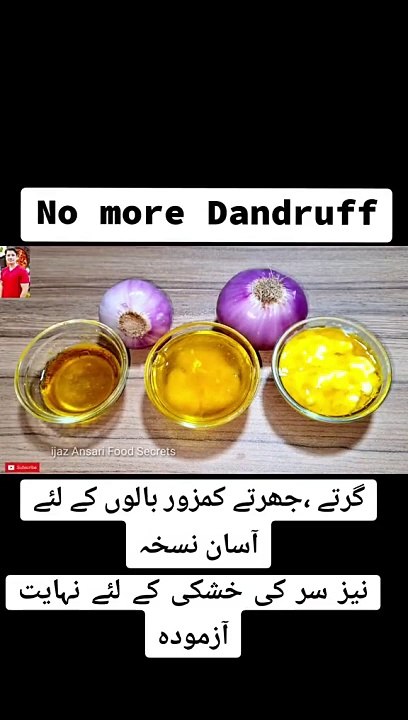 Hair fall and Dandruff Home remedy 100%