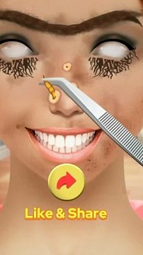 Asmr Worm Maggots Removal Animation Infected Face Treatment asmr animation satisfy