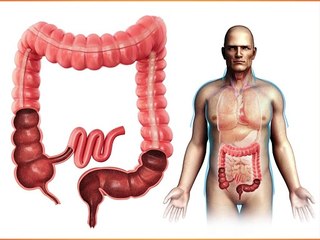 colitis symptoms causes and treatment in hindi || कोलाइटिस की पूरी जानकारी