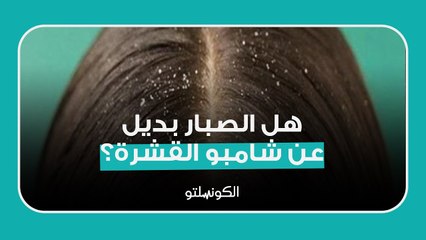 هل الصبار بديل عن شامبو القشرة؟