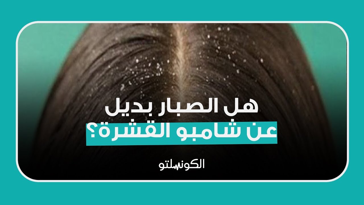 هل الصبار بديل عن شامبو القشرة؟