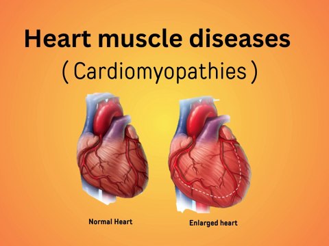 cardiomyopathy || 5 diseases of the heart muscle due to which one can die