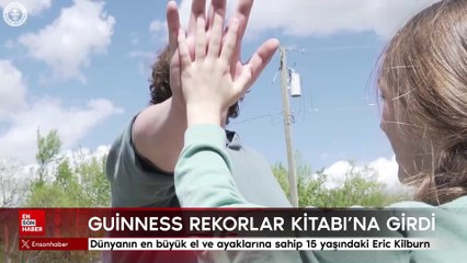 Dünyanın en büyük el ve ayaklarına sahip 15 yaşındaki Eric Kilburn