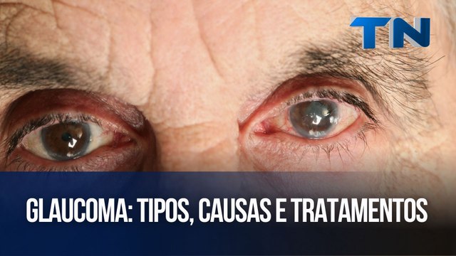 Glaucoma: Tipos, causas e tratamentos | Cuide-se Bem!