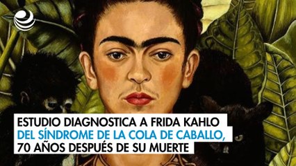 Estudio diagnostica a Frida Kahlo del síndrome de la cola de caballo, 70 años después de su muerte