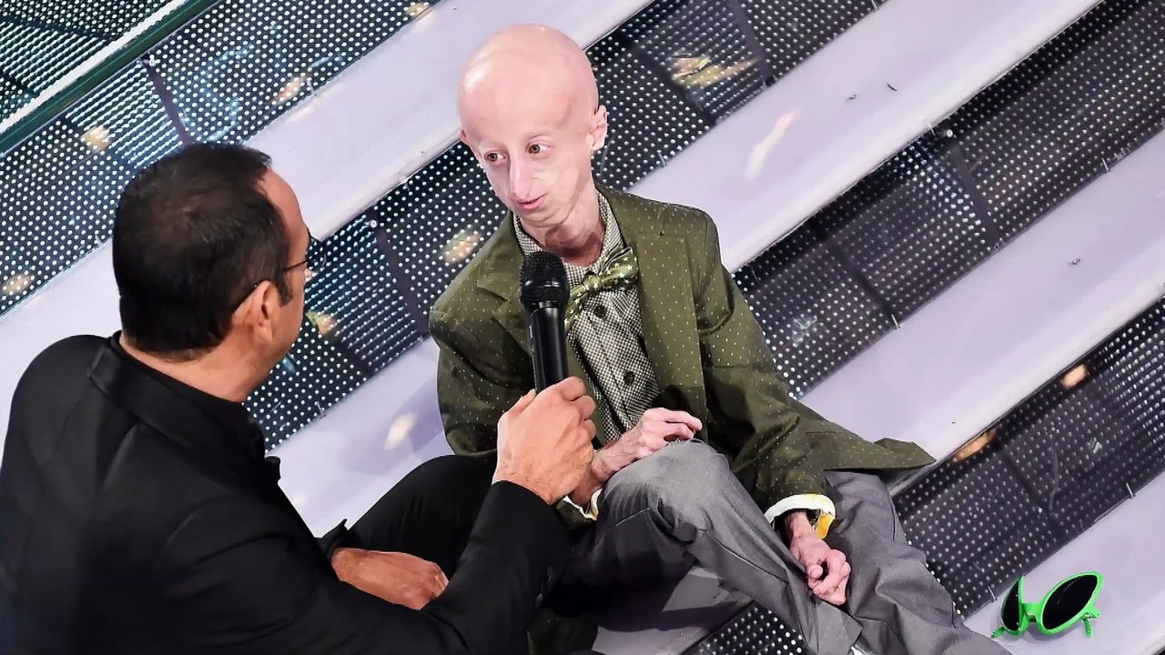 Sammy Basso_ Oldest Living Person With Progeria_ Dies at 28 video