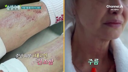[예고] 중년 여성 피부 노화의 원인 갱년기! 콜라겐을 채워라!