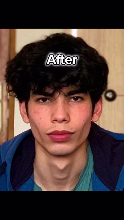 Facial