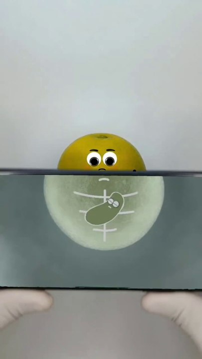 Orange needs surgery to give birth to a baby#Confusing Behavior Awards#Fruit Surgery#Fruit Doctor#Creative Crafts