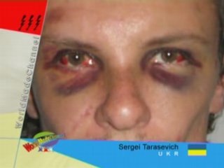 bandits almost killed him