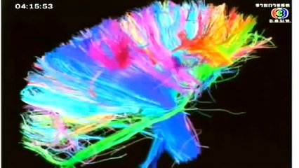 ความลับของสมอง