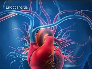 spleen information in hindi, why does spleen hurt, what to eat for pain in the spleen,