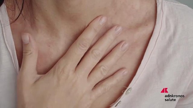 Dermatite atopica, anticorpo monoclonale tralokinumab approvato anche per adolescenti con forma moderata grave