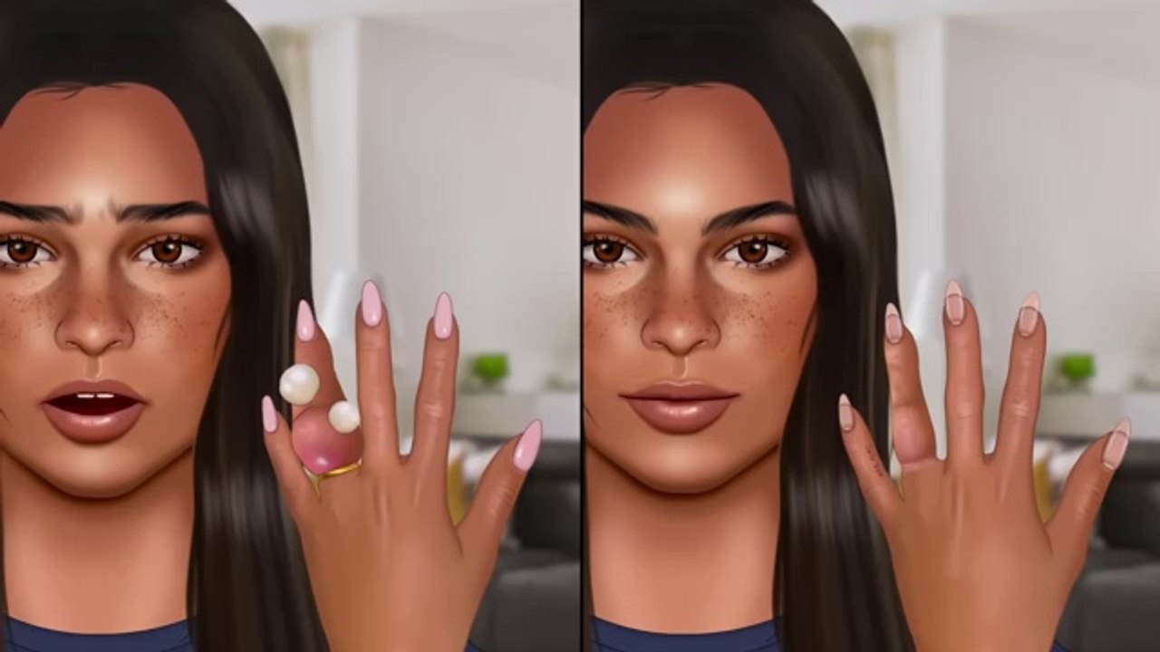 ASMR _ Treating an Infected Finger from an Old Wedding Ring _ Nail Treatment _ Finger Swelling