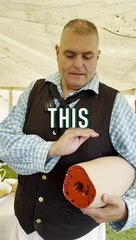 This is how amputation was performed in 1805