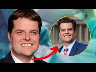 Matt Gaetz&apos;s Transformation is Turning Heads