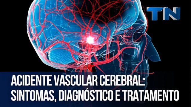 AVC: Sintomas, diagnóstico e tratamento | Cuide-se Bem!