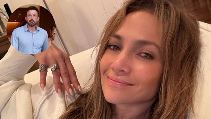 Jennifer Lopez se somete a cirugía estética tras su divorcio de Ben Affleck