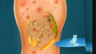 ASMR Remove Fungal infection Foot Care Treatment Animation  shorts anime  relaxing