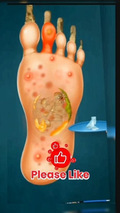 ASMR Remove Fungal infection Foot Care Treatment Animation  shorts anime  relaxing