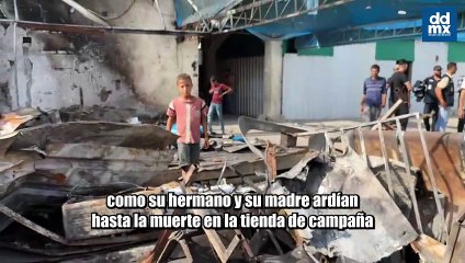 Mohamed, el niño palestino que vio arder a su madre y su hermano tras un ataque israelí