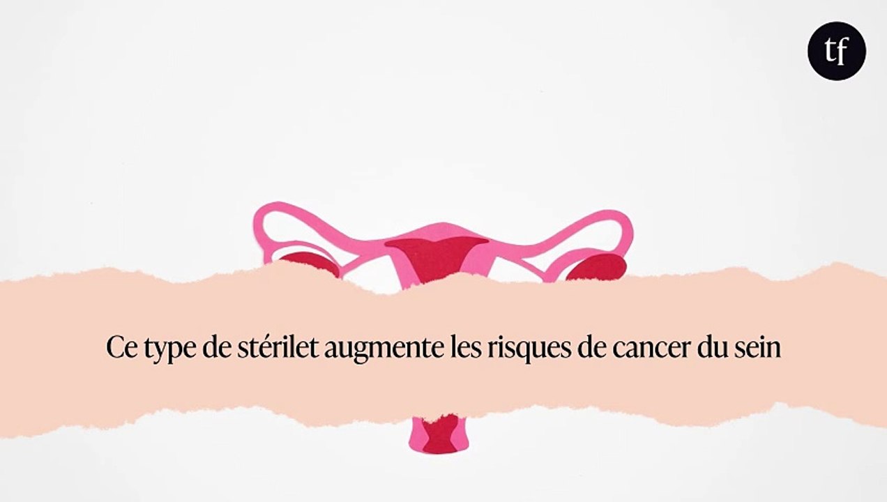 Ce type de stérilet augmente les risques de cancer du sein