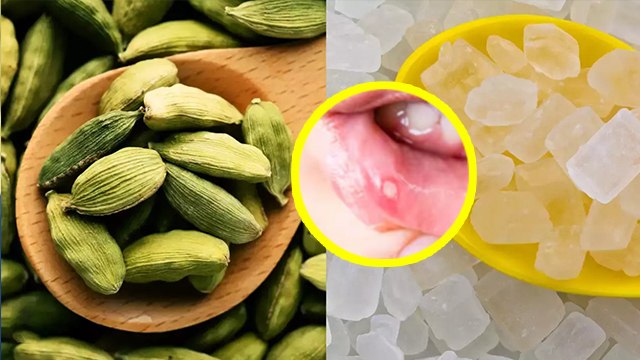 Mishri Aur Elaichi Khane Se Kya Hota Hai, Mouth Bad Smell And Better Sleep Treatment | Boldsky