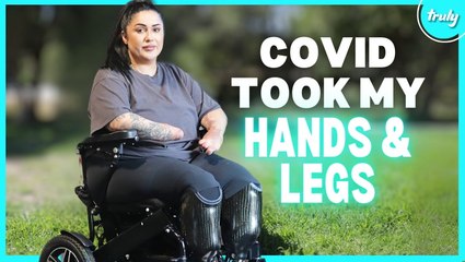 I Caught COVID-19 & Lost My Limbs | BORN DIFFERENT
