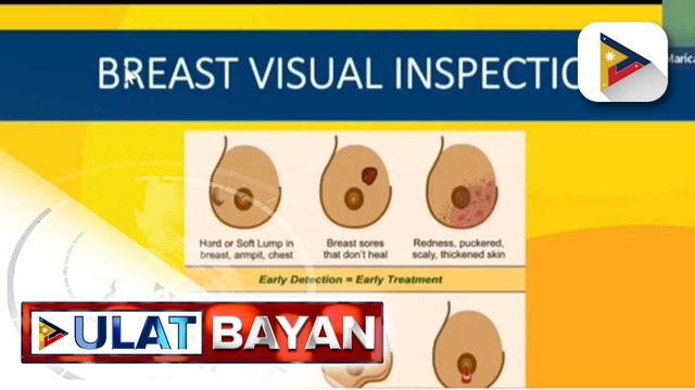 Kahalagahan ng pagkakaroon ng kaalaman tungkol sa sakit na breast cancer, binigyang-diin ng DOH
