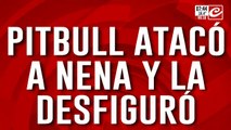 Otro ataque de perros asesinos: pitbull desfiguró a nena de ocho años