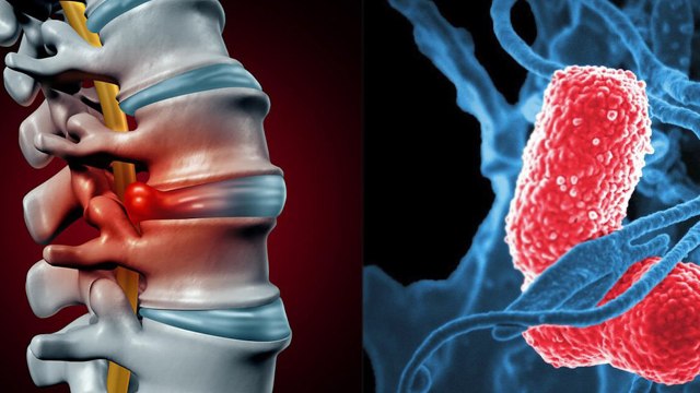 Constent Lower Back Pain : Lagaatar Kamar Dard Kyu Hota Hai | Boldsky