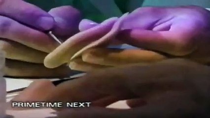 Who Wants to Be A Millionaire ABC Split Screen Credits