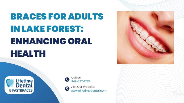 Braces for Adults in Lake Forest Enhancing Oral Health