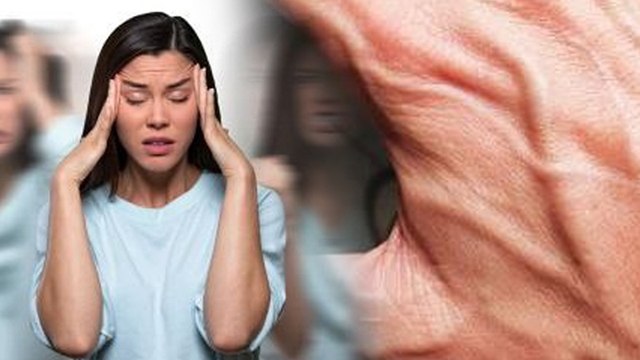 Veins On Hands Popping Up Causes & Treatment: हाथों की नसें क्यों दिखती है, कारण और इलाज | Boldsky