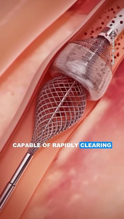 Clear Blood Vessels Instantly #shorts