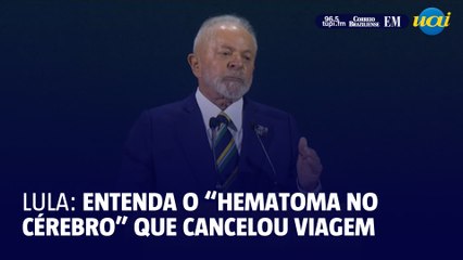 O que é 'hematoma no cérebro', que fez Lula cancelar viagem à Rússia?