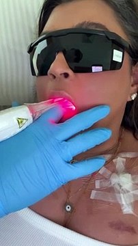 Em tratamento contra câncer, Preta Gil realiza técnica com laser: Por causa da quimioterapia