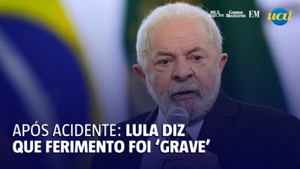 Lula fala sobre acidente doméstico no fim de semana