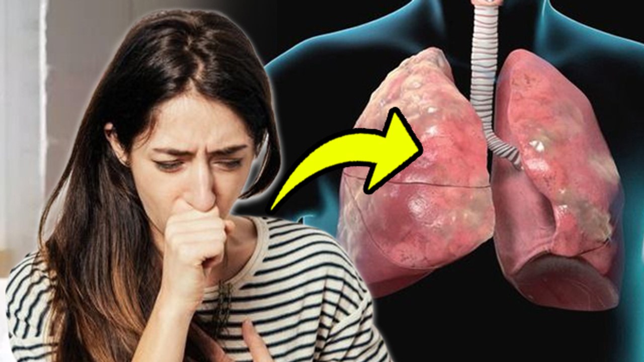 COPD Disease Kya Hai,COPD Symptoms And Treatmen...