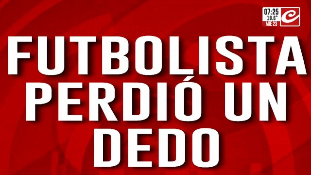 Pierde un dedo tras la explosión de petardo arrojado por sus propios hinchas