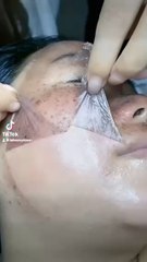 RETIRE TES TACHES SUR TON VISAGE EN 24H !!!