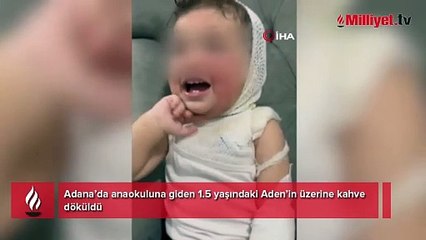 Kreşte 1,5 yaşındaki çocuk kahve ile yandı! Anne isyan etti
