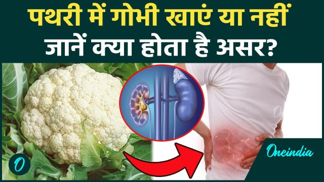 Cabbage Causes Kidney Stone : पथरी होने पर गोभी खाएं या नहीं, जानें शरीर पर पड़ता है कैसा असर ?