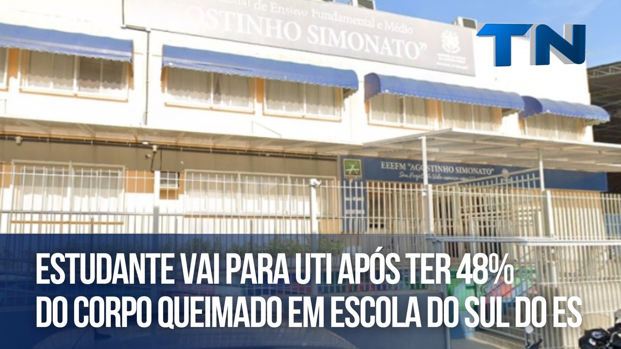 Estudante vai para UTI após ter 48% do corpo queimado em escola do Sul do ES