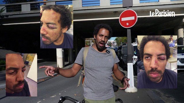 Il est fou, il va le tuer ! : ce cycliste a été passé à tabac quelques heures après l'agression mortelle de Paul Varry