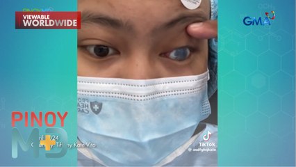Babae, halos mabulag ang kanang mata dahil sa chemical burn | Pinoy MD