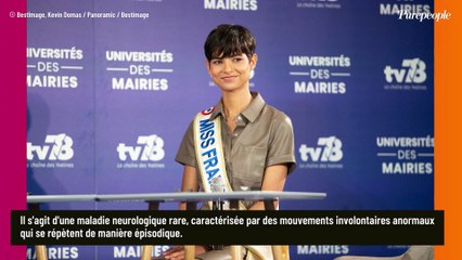 Eve Gilles révèle être atteinte de dyskinésie paroxystique et dévoile les conséquences sur son corps