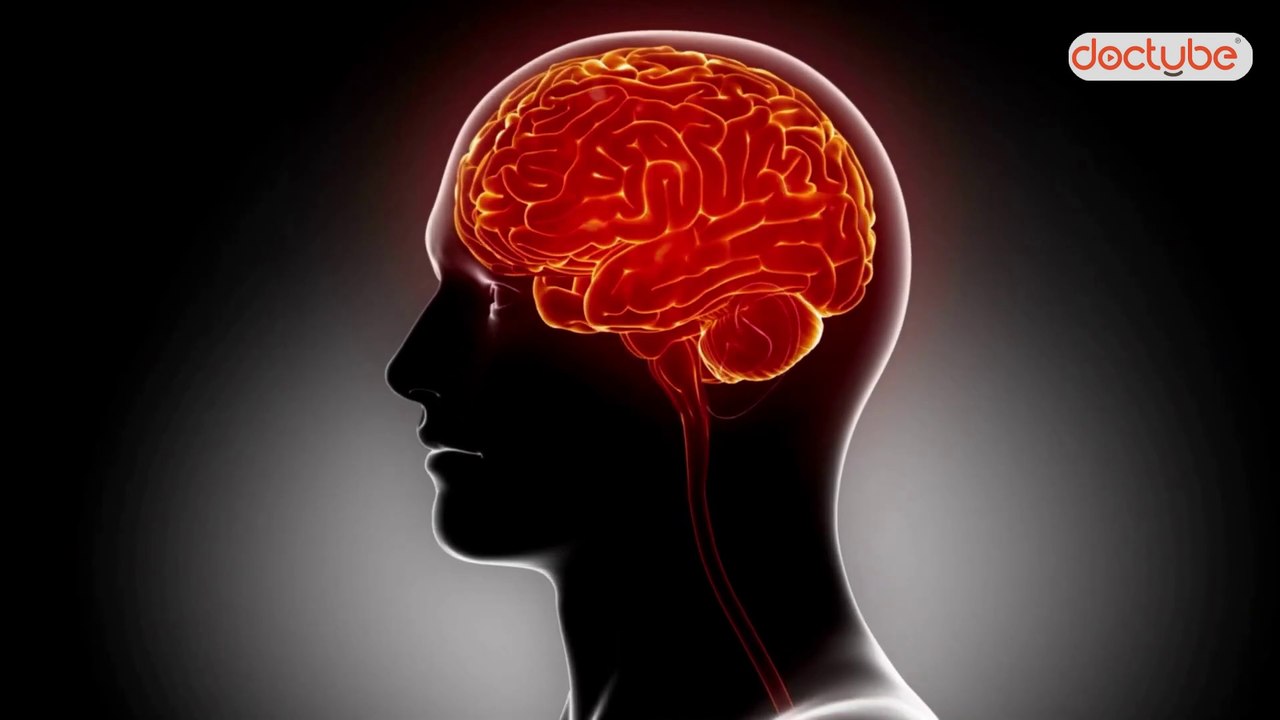 Early Stroke Symptoms You Should Never Ignore