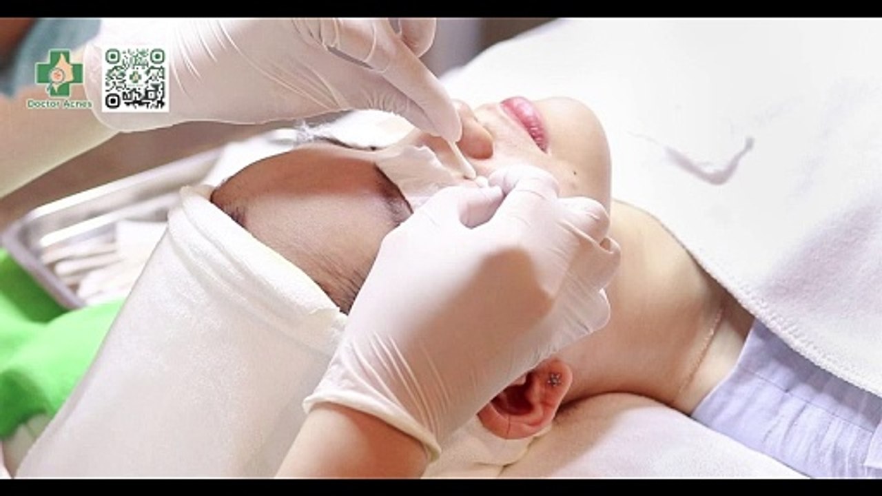 Không nặn mụn có tự hết không? Loại mụn nào nên và không nên nặn?